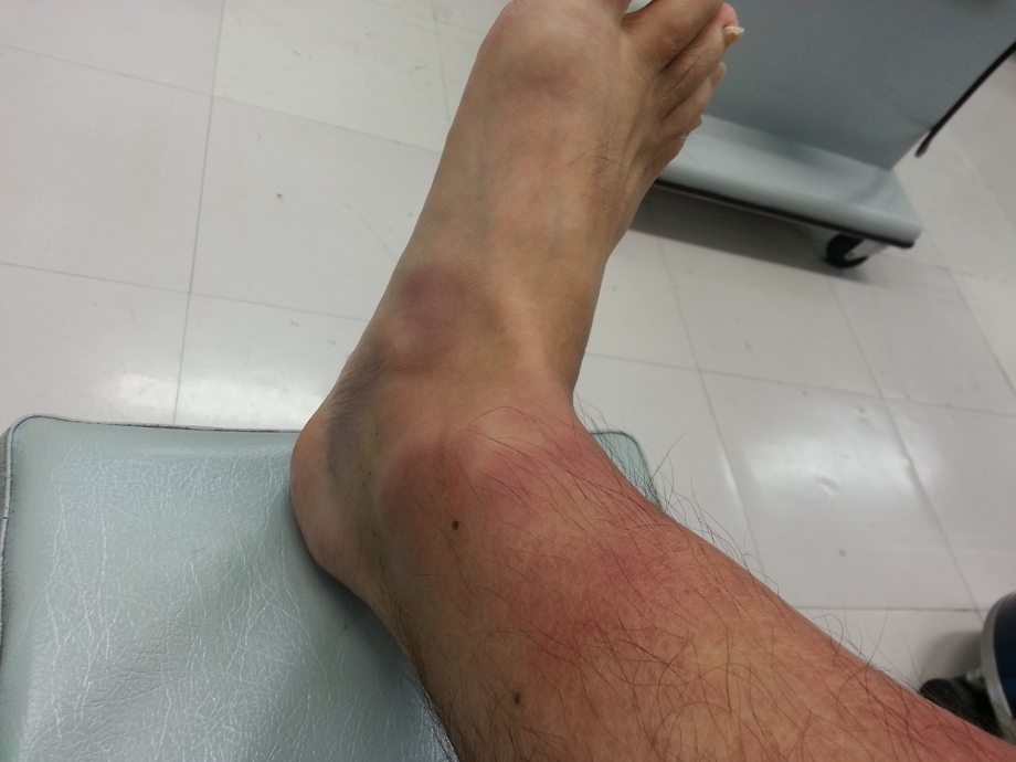 いつ医療援助を受けるべきか